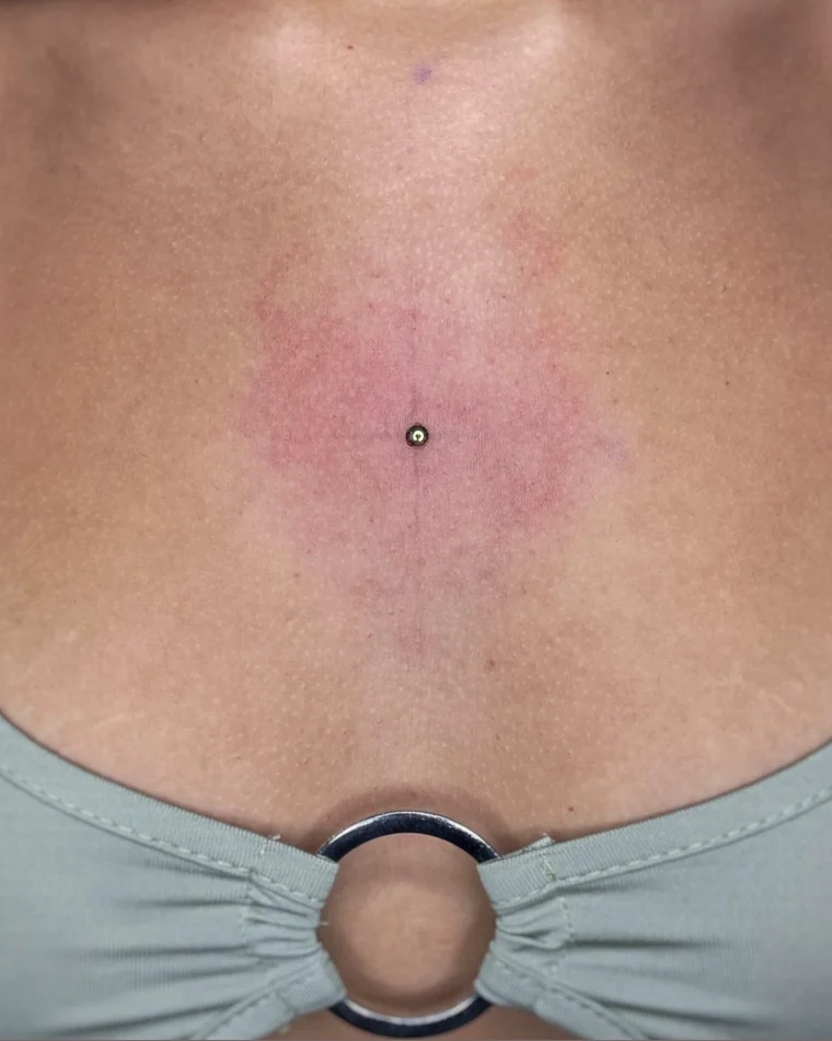 Microdermal no tórax feito por aluna da Maria